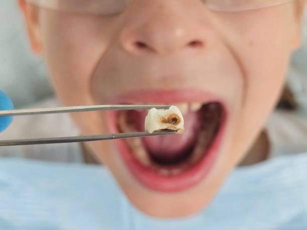 Best After-Hours Emergency Dentist in Mount Hermon, CA